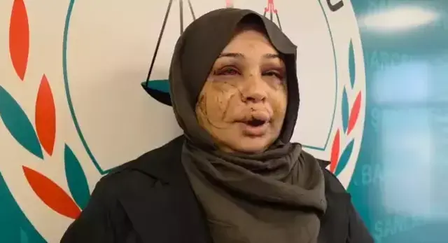 Eşini bu hale getiren Cumhurbaşkanı Koruma Dairesi personeli tutuklandı